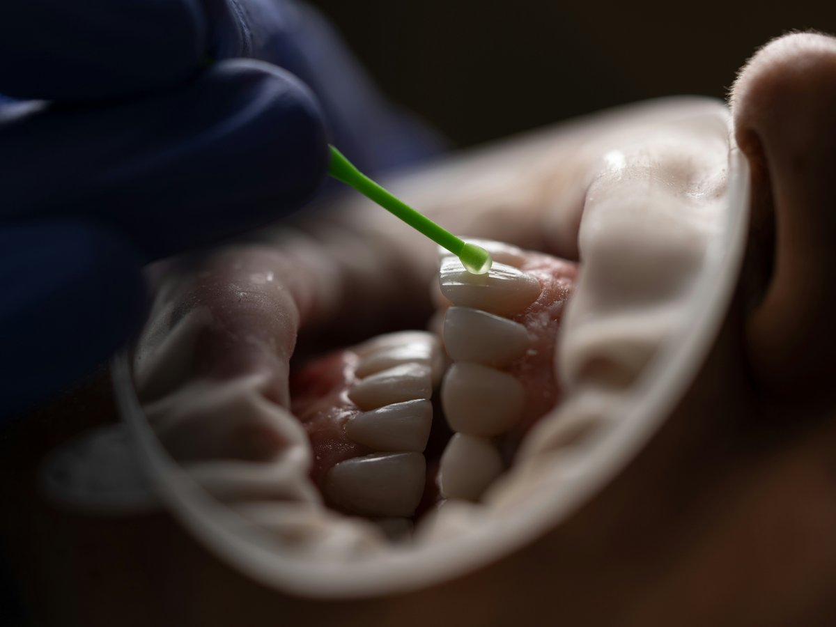 Réhabilitation orale chez Dental Opus